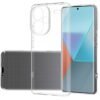 Xiaomi Redmi Note 13 Pro Plus Kılıf Lüx Şeffaf Silikon-(5796)